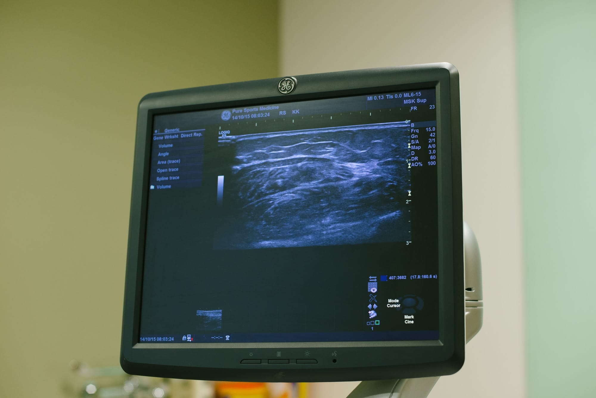 Close up of a screen displaying a scan