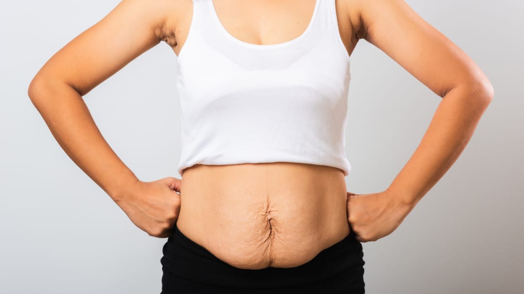 post natal tummy