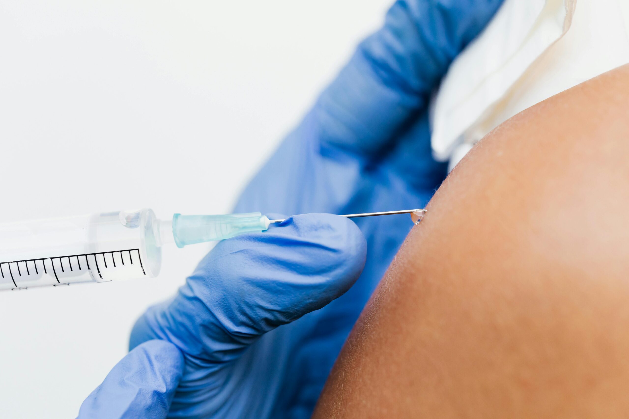 Arthrosamid Injections